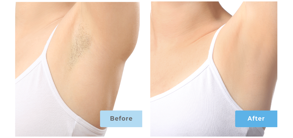 Slider-Images-After2-1