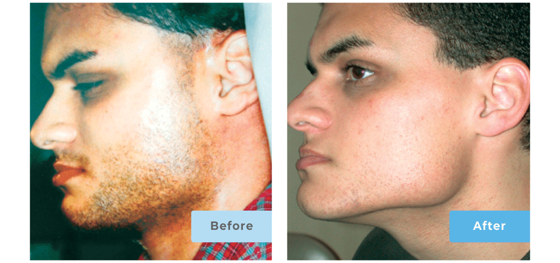 Slider-Images-After3-1