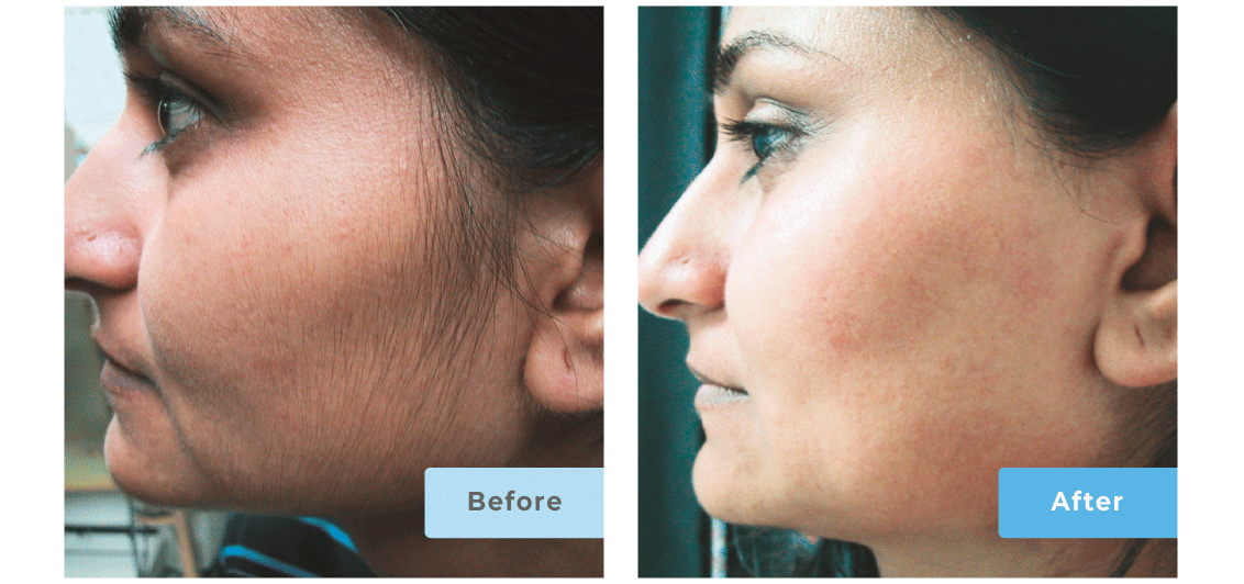 Slider-Images-After4-1