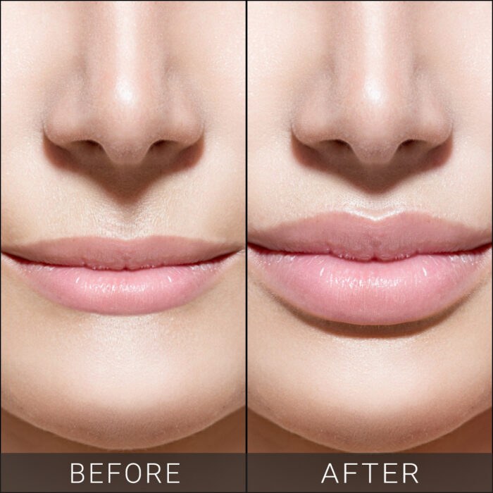 Lip-Reshaping